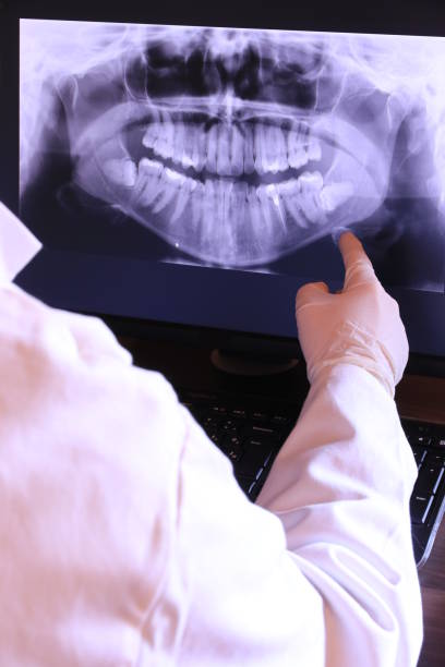 Best Emergency Treatment for Dental Infections or Abscesses in Scottsboro, AL